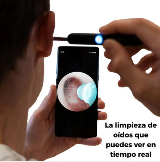 ClearView® HD – Limpieza Segura de Oídos con Cámara en Vivo 👂✨